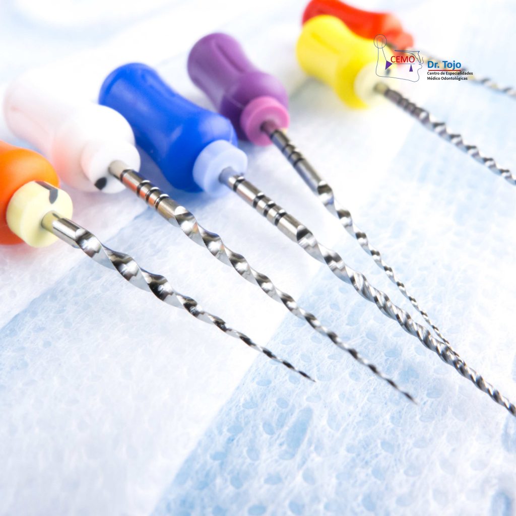 Endodoncia: la solución para conservar tu diente y eliminar el dolor