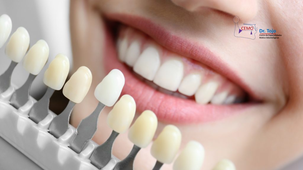 ¿Puede el blanqueamiento dental dañar los dientes?