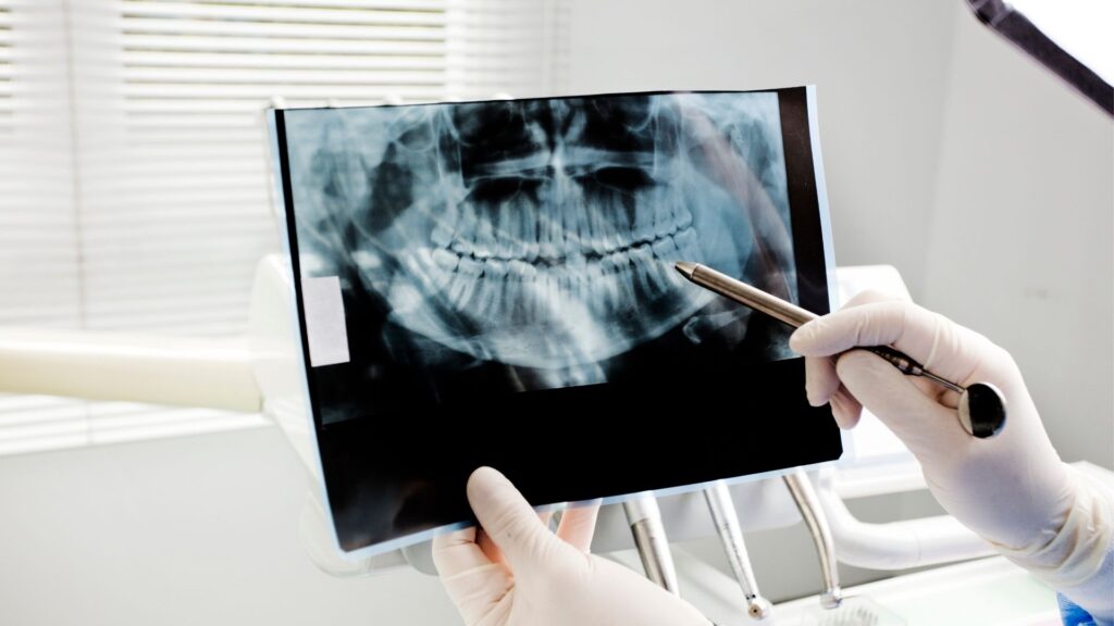 ¿Son necesarias las radiografías dentales?